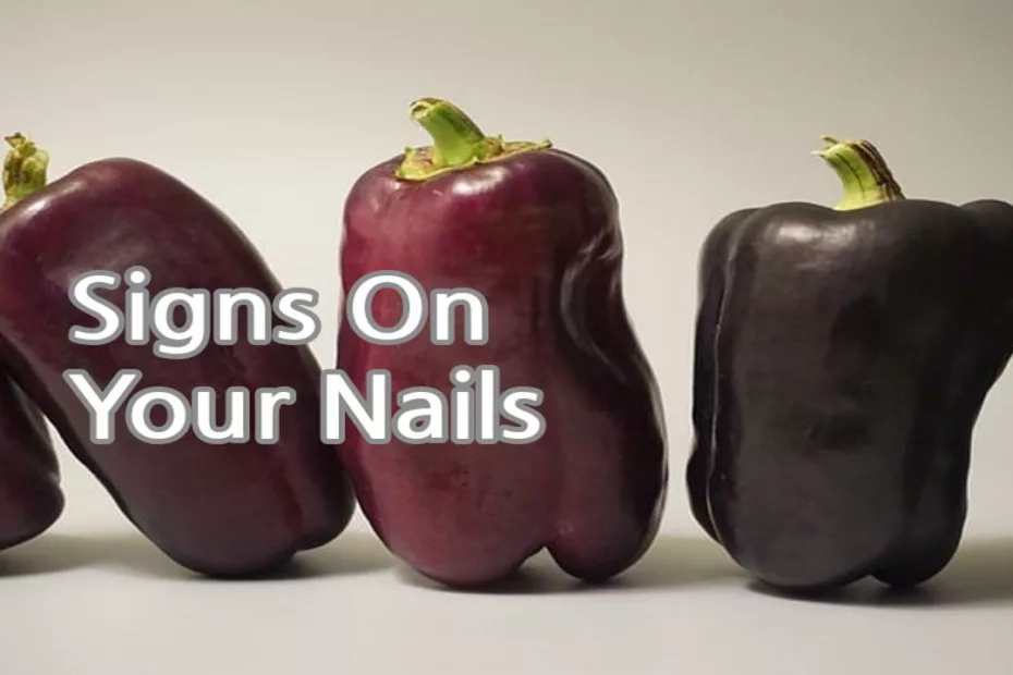 Signs On Your Nails